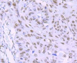RBBP4/RbAp48 Antibody (JU37-47), Novus Biologicals 100 &mu;l; Unconjugated:Antibodies,