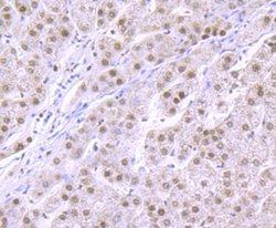 RBBP4/RbAp48 Antibody (JU37-47), Novus Biologicals 100 &mu;l; Unconjugated:Antibodies,