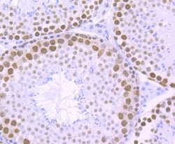 RBBP4/RbAp48 Antibody (JU37-47), Novus Biologicals 100 &mu;l; Unconjugated:Antibodies,