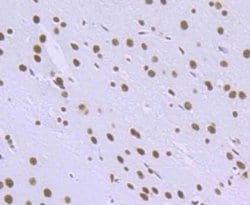 RBBP4/RbAp48 Antibody (JU37-47), Novus Biologicals 100 &mu;l; Unconjugated:Antibodies,