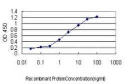 RBBP6 Antibody (5A11), Novus Biologicals 0.1 mg | Buy Online | Novus Biologicals | Fisher Scientific