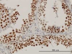 RBBP6 Antibody (5A11), Novus Biologicals 0.1 mg | Buy Online | Novus Biologicals | Fisher Scientific