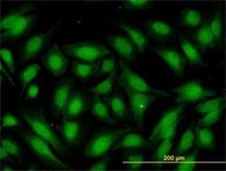 RBBP9 Antibody (2A11), Novus Biologicals 100 &mu;g | Buy Online | Novus Biologicals | Fisher Scientific