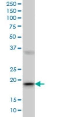 RBBP9 Antibody (2A11), Novus Biologicals 100 &mu;g | Buy Online | Novus Biologicals | Fisher Scientific