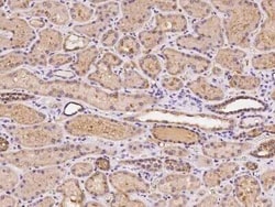 RBCK1 Antibody, Novus Biologicals 50 &mu;g, Unconjugated:Antibodies, Polyclonal