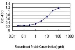 RBEL1 Antibody (2E11-1F10), Novus Biologicals 0.1 mg | Buy Online | Novus Biologicals | Fisher Scientific