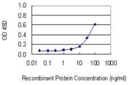 RBJ Antibody (3C1), Novus Biologicals 0.1 mg | Buy Online | Novus Biologicals | Fisher Scientific
