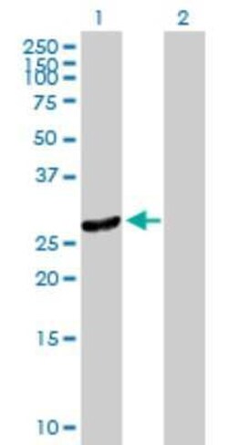 RBJ Antibody, Novus Biologicals 0.05 mg, Unconjugated:Antibodies, Polyclonal