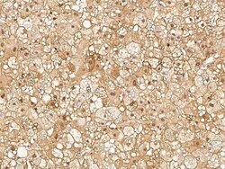 RBKS Antibody, Novus Biologicals 50 &mu;g | Buy Online | Novus Biologicals | Fisher Scientific