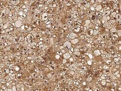 RBKS Antibody, Novus Biologicals:Anticuerpos:Anticuerpos primarios