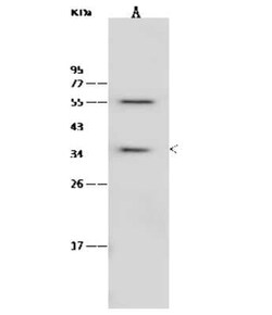 RBKS Antibody, Novus Biologicals:Anticuerpos:Anticuerpos primarios
