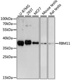 RBM11 Antibody - Azide and BSA Free, Novus Biologicals 0.02 mL; Unconjugated:Antibodies,