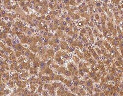 RBM12B Antibody, Novus Biologicals 50 &mu;g | Buy Online | Novus Biologicals | Fisher Scientific