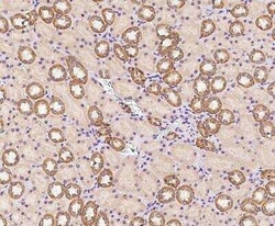 RBM12B Antibody, Novus Biologicals 50 &mu;g | Buy Online | Novus Biologicals | Fisher Scientific