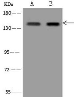 RBM12B Antibody, Novus Biologicals 50 &mu;g | Buy Online | Novus Biologicals | Fisher Scientific