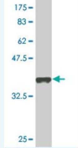 RBM14 Antibody (4E1), Novus Biologicals 100 &mu;g | Buy Online | Novus Biologicals | Fisher Scientific