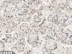 RBM14 Rabbit anti-Human, Polyclonal, Novus Biologicals:Antibodies:Primary
