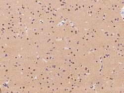 RBM17 Antibody, Novus Biologicals 50 &mu;g, Unconjugated:Antibodies, Polyclonal