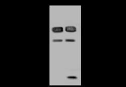 RBM17 Antibody, Novus Biologicals 50 &mu;g, Unconjugated:Antibodies, Polyclonal