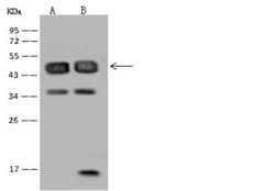 RBM17 Antibody, Novus Biologicals 50 &mu;g, Unconjugated:Antibodies, Polyclonal