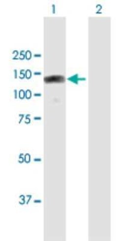 RBM19 Antibody, Novus Biologicals 0.05 mg; Unconjugated:Antibodies, Polyclonal