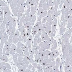 RBM20 Rabbit anti-Human, Polyclonal, Novus Biologicals 25 &mu;g; Unconjugated:Antibodies,