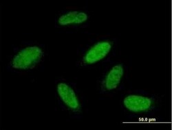 RBM23 Antibody, Novus Biologicals 0.05 mg | Buy Online | Novus Biologicals | Fisher Scientific