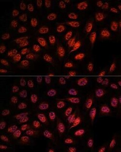 RBM25 Antibody - Azide and BSA Free, Novus Biologicals 0.02 mL; Unconjugated:Antibodies,