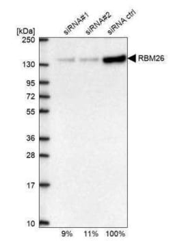 RBM26 Antibody, Novus Biologicals 0.1 mL; Unconjugated:Antibodies, Polyclonal