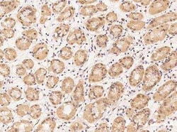 RBM28 Antibody, Novus Biologicals:Antibodies:Primary Antibodies