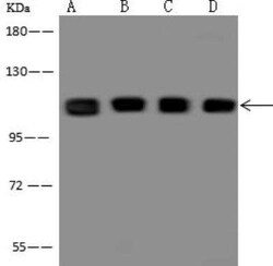 RBM28 Antibody, Novus Biologicals:Antibodies:Primary Antibodies