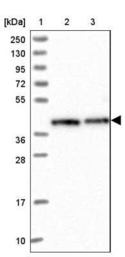 RBM4 Antibody, Novus Biologicals:Antibodies:Primary Antibodies