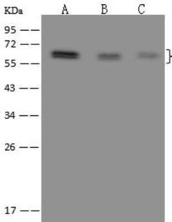 RBM42 Antibody, Novus Biologicals 50 &mu;g; Unconjugated:Antibodies, Polyclonal