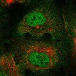 RBM46 Rabbit anti-Human, Polyclonal, Novus Biologicals 100 &mu;g; Unconjugated:Antibodies,