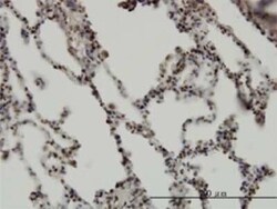 RBM5 Antibody (2B6), Novus Biologicals 0.1 mg | Buy Online | Novus Biologicals | Fisher Scientific