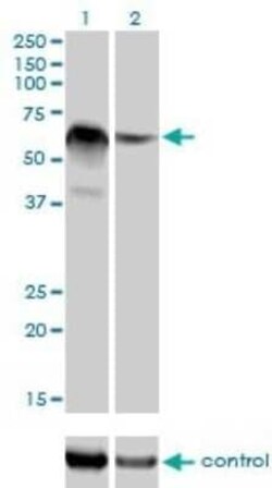 RBM5 Antibody (2B6), Novus Biologicals 0.1 mg | Buy Online | Novus Biologicals | Fisher Scientific