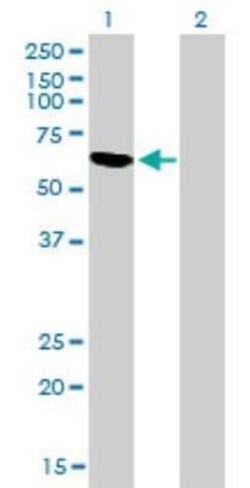 RBM5 Antibody (2B6), Novus Biologicals 0.1 mg | Buy Online | Novus Biologicals | Fisher Scientific