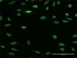 RBM5 Antibody (3G6), Novus Biologicals 0.1 mg | Buy Online | Novus Biologicals | Fisher Scientific