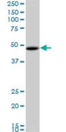 Novus Biologicals RBMS1 Antibody (M1), Novus Biologicals 0.1 mg | Buy Online | Novus Biologicals&trade; | Fisher Scientific
