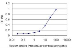 RBMS2 Antibody (4E2), Novus Biologicals 0.1 mg | Buy Online | Novus Biologicals | Fisher Scientific