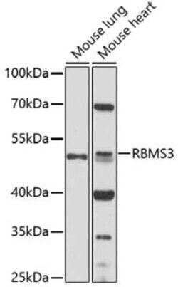 RBMS3 Antibody - Azide and BSA Free, Novus Biologicals 0.1 mL, Unconjugated:Antibodies,
