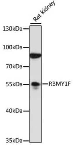 RBMY1F Antibody - Azide and BSA Free, Novus Biologicals 0.02 mL; Unconjugated:Antibodies,