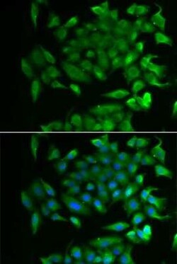 RBP2 Antibody - BSA Free, Novus Biologicals:Antibodies:Primary Antibodies