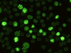 RBP4/Retinol-Binding Protein 4 Rabbit anti-Mouse, Clone: 8, Novus Biologicals:Antibodies:Primary