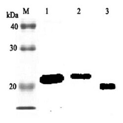 RBP4/Retinol-Binding Protein 4 Antibody, Novus Biologicals 100 ug; Unconjugated:Antibodies,