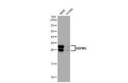 RBPMS Antibody (HL1105), Novus Biologicals 100 &mu;g; Unconjugated:Antibodies,
