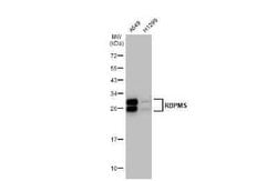 RBPMS Antibody (HL1106), Novus Biologicals 100 &mu;g | Buy Online | Novus Biologicals | Fisher Scientific