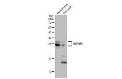 RBPMS Antibody (HL1106), Novus Biologicals 100 &mu;g | Buy Online | Novus Biologicals | Fisher Scientific