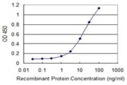 RBPMS Antibody (1C12), Novus Biologicals 0.1 mg | Buy Online | Novus Biologicals | Fisher Scientific