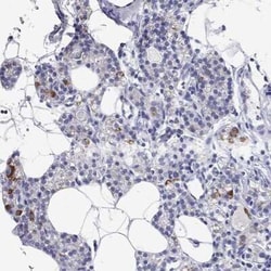 RCAN1 Rabbit anti-Human, Polyclonal, Novus Biologicals 100 &mu;g; Unconjugated:Antibodies,